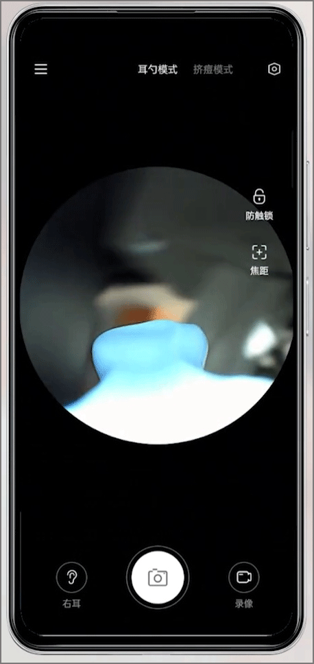 xlife掏耳勺app截图3